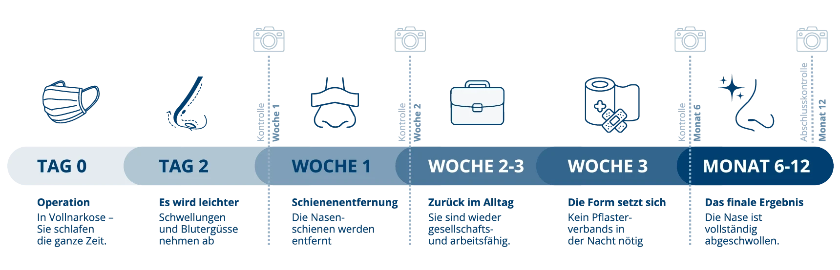 Zeitstrahl der Erholung nach einer Nasenkorrektur. Tag 0: Operation in Vollnarkose, Sie schlafen die ganze Zeit. Tag 2: Es wird leichter, Schwellungen und Blutergüsse nehmen ab. Woche 1: Schienenentfernung, die Nasenschienen werden entfernt, Kontrolle. Woche 2 bis 3: Zurück im Alltag, Sie sind wieder gesellschafts- und arbeitsfähig, Kontrolle. Woche 3: Die Form setzt sich, kein Pflasterverband in der Nacht nötig. Monat 6 bis 12: Das finale Ergebnis, die Nase ist vollständig abgeschwollen, Abschlusskontrolle.